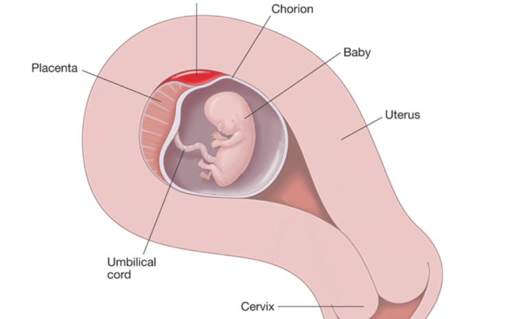 Causes of Hemorrhage in Early Pregnancy