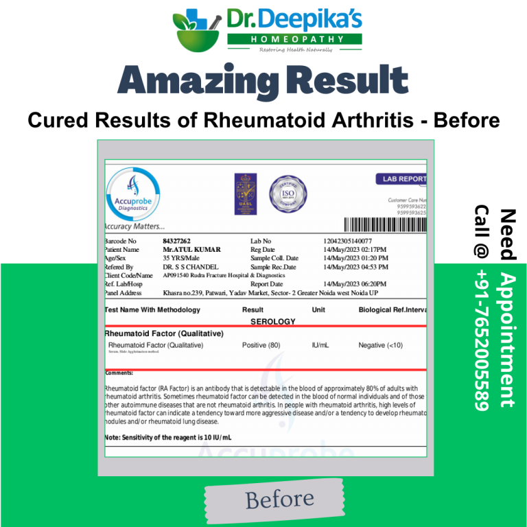 Revitalizing Lives: Triumph Over Rheumatoid Arthritis at Dr. Deepika's Homeopathy After Report