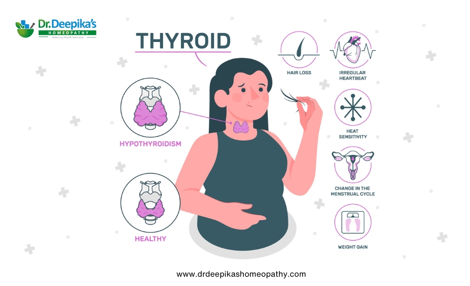 thyroid nodule treatment in homeopathy