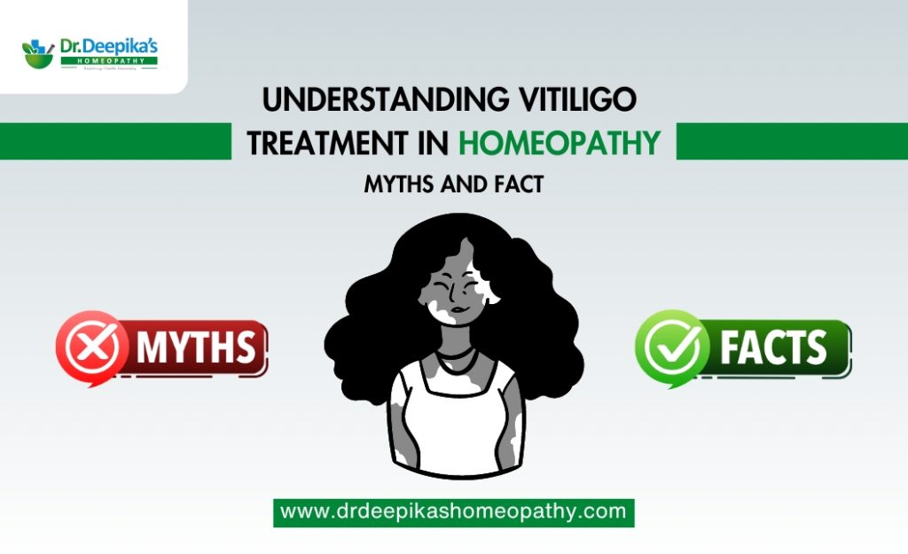 homeopathy medicine for vitiligo