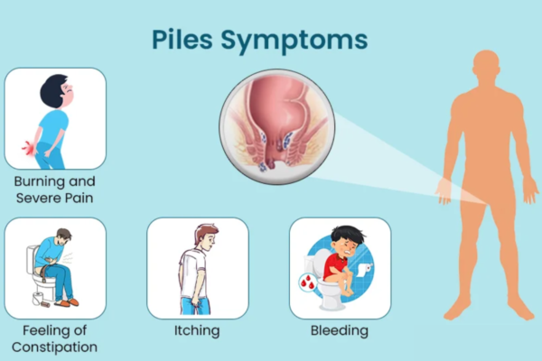 Symptoms of piles