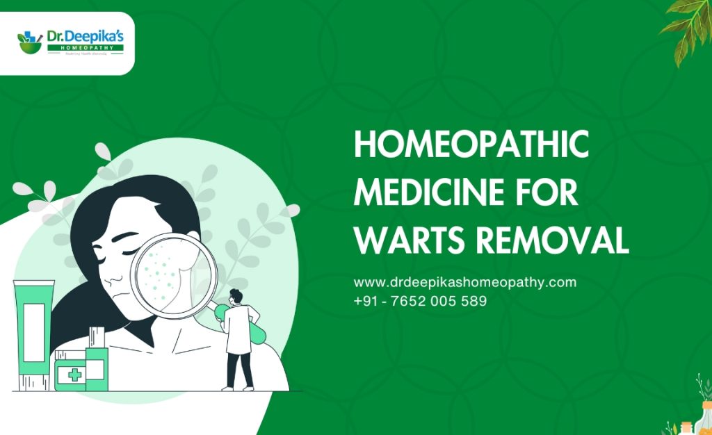 homeopathic treatment for warts on face