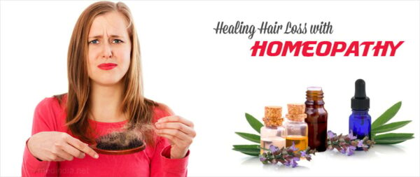 homeopathy treatment for hair loss