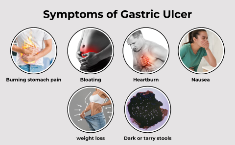 symptoms of gastric ulcer