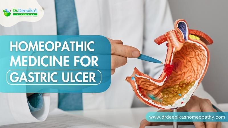 Homeopathic Medicine for Gastric Ulcer