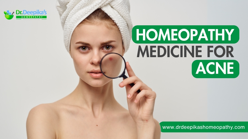 Homeopathy Medicine for Acne