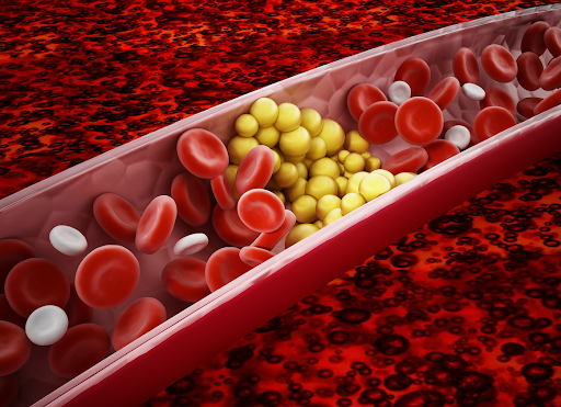 Triglycerides