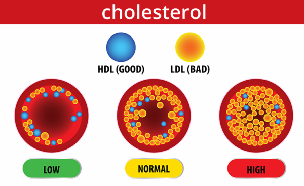 best homeopathic medicine for high cholesterol and triglycerides