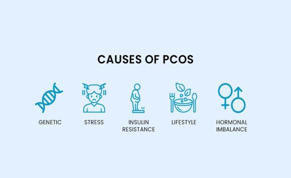 causes of pcos