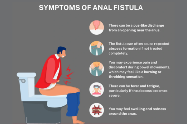 Symptoms of Fistula