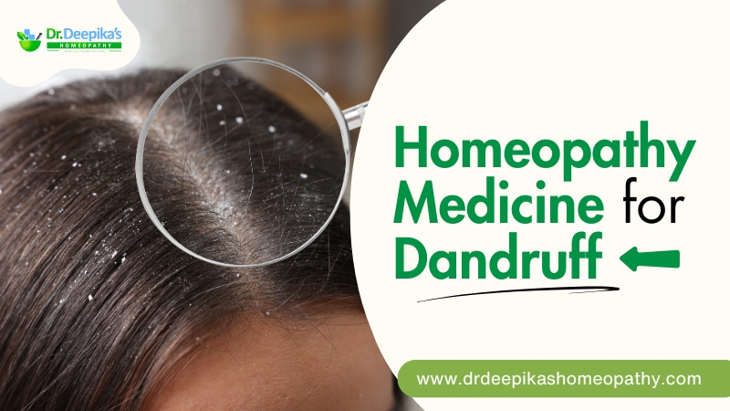 Homeopathy Medicine for Dandruff