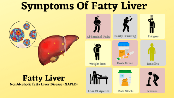 Fatty Liver Symptoms