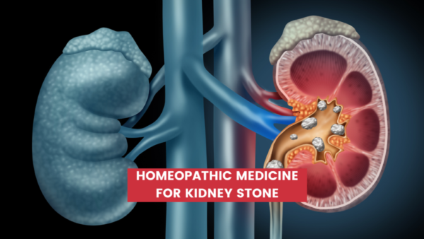 homeopathic medicine for kidney stone