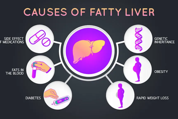 Fatty Liver Causes