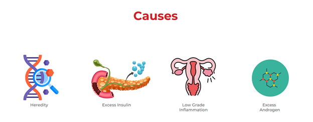 Causes of PCOS and PCOD