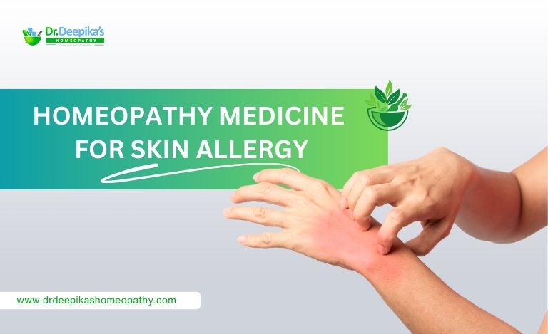 Homeopathy Medicine for Skin Allergy | Dr. Deepika