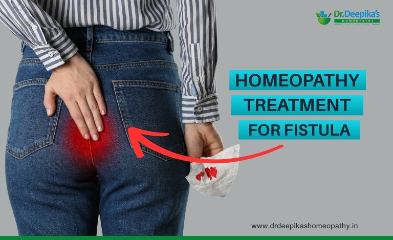 Homeopathy Treatment for Fistula