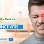 Homeopathic Medicine for Conjunctivitis