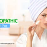 Homeopathic Treatment for Acne