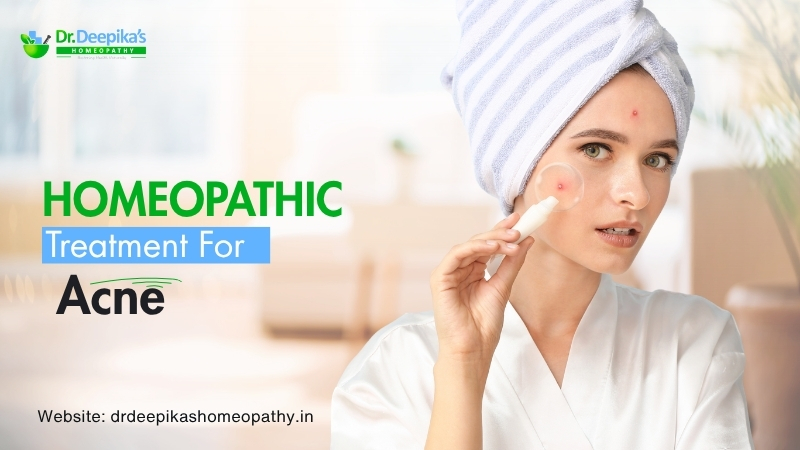 Homeopathic Treatment for Acne