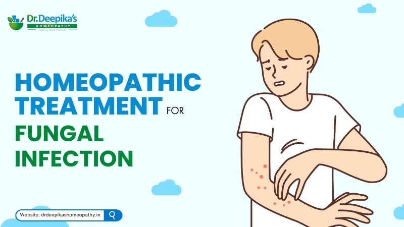Homeopathic Treatment for Fungal Infection