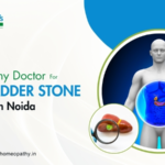 Homeopathy Doctor for Gallbladder Stone Treatment in Noida