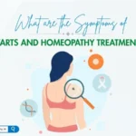Symptoms of Warts