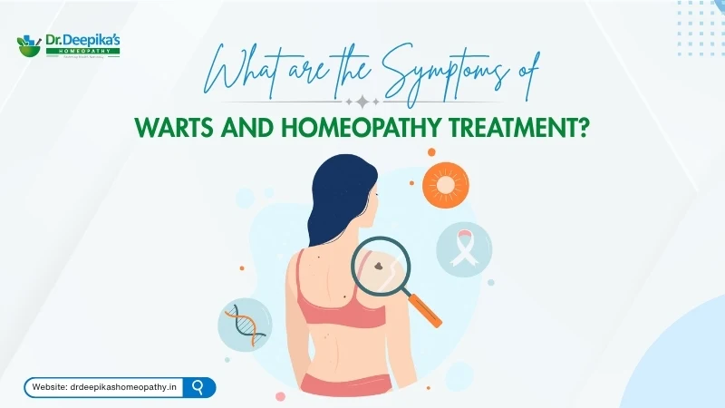What are the Symptoms of Warts and Homeopathy Treatment?
