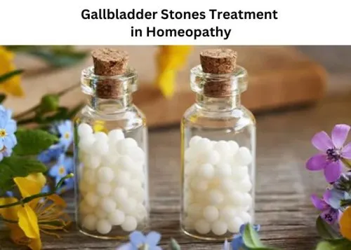 Homeopathy Treatment for Gallbladder Stones