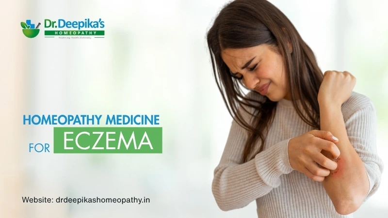 Homeopathy Medicine for Eczema