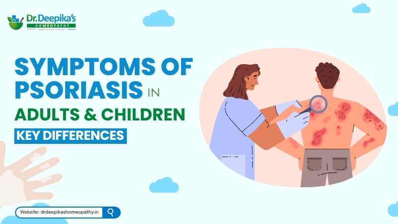 Symptoms of Psoriasis