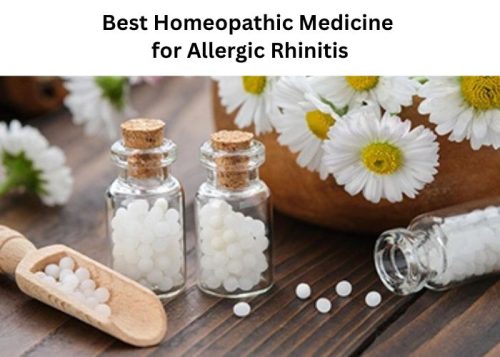 Best Homeopathic Medicine for Allergic Rhinitis