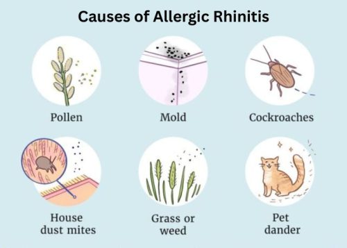 Causes of Allergic Rhinitis