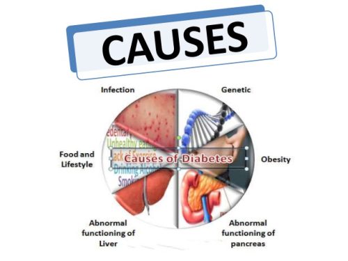 Causes of Diabetes