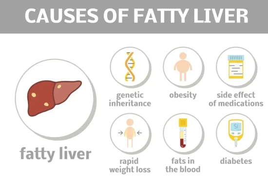 Causes of Fatty Liver