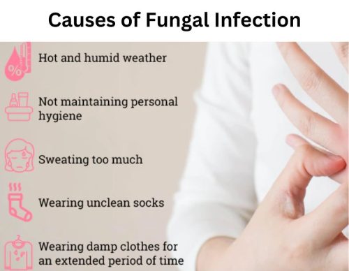 Causes of Fungal Infection