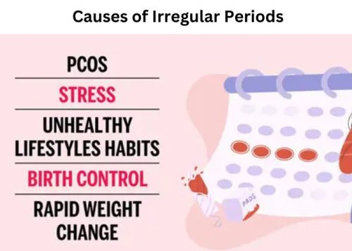 Causes of Irregular Periods