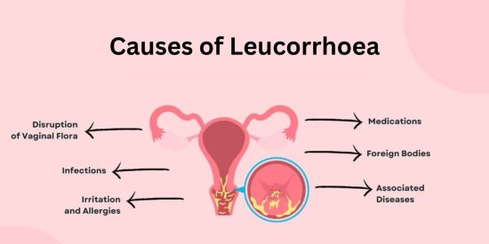 Causes of Leucorrhoea