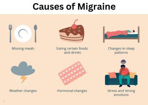 Causes of Migraine