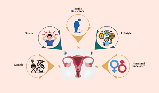 Symptoms of PCOD