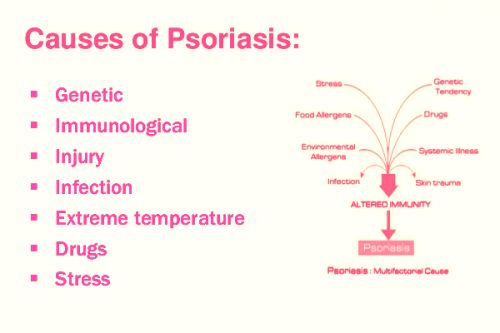 Causes of Psoriasis