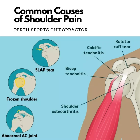 Causes of Shoulder Pain