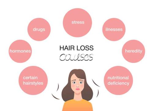 Causes of hair loss Causes of hair loss