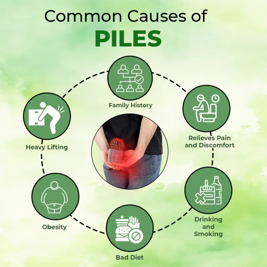 What Causes Piles?