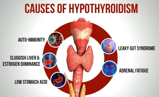 Causes of thyroid