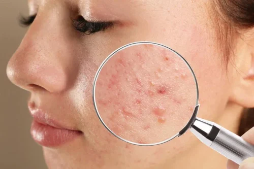 Homeopathy Dermatologist Doctor