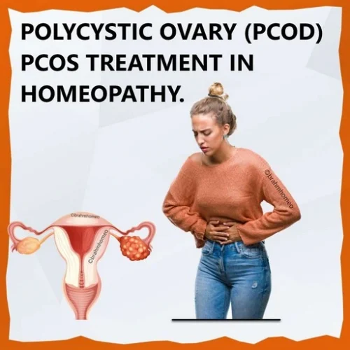 Homeopathy Treatment for PCOD