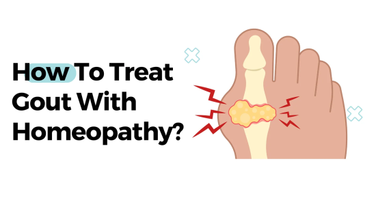 Homeopathy for Uric Acid Treatment