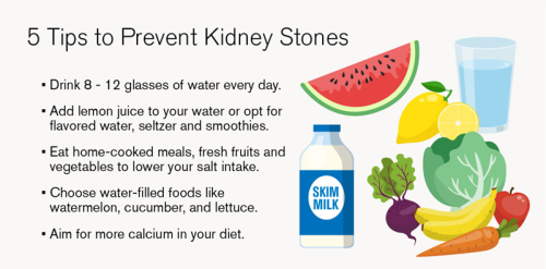 Prevention of Kidney Stone Prevention of Kidney Stones