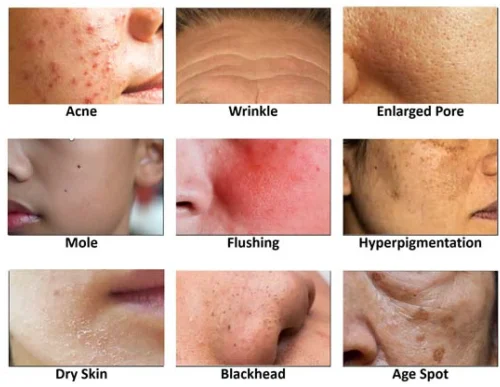 Skin Problems Treated by Homeopathy